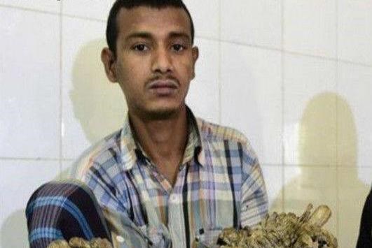 A man in India has a strange disease and the branches are covered with branches. His wife abandoned him after giving birth to two children!_Picture 1 A man in India has a strange disease and the branches are covered with branches. His wife abandoned him after giving birth to two children!_Picture 1